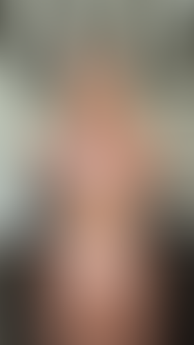 Geblurrte Content-Vorschau