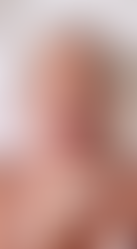Geblurrte Content-Vorschau