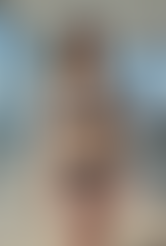 Geblurrte Content-Vorschau