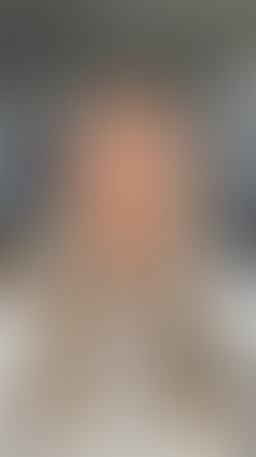 Geblurrte Content-Vorschau