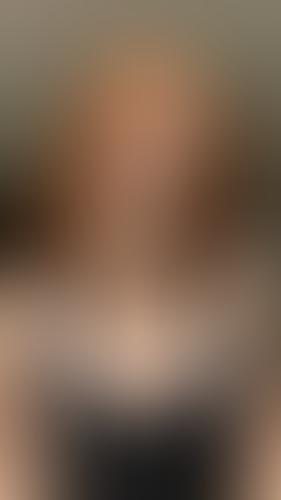 Geblurrte Content-Vorschau