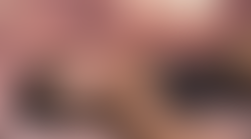 Geblurrte Content-Vorschau