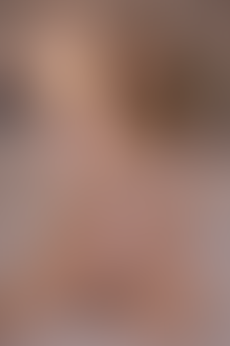 Geblurrte Content-Vorschau