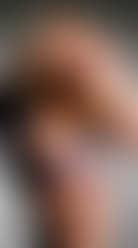 Geblurrte Content-Vorschau