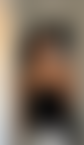 Geblurrte Content-Vorschau