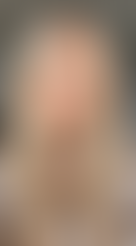 Geblurrte Content-Vorschau