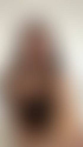 Geblurrte Content-Vorschau
