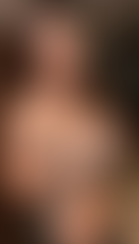 Geblurrte Content-Vorschau