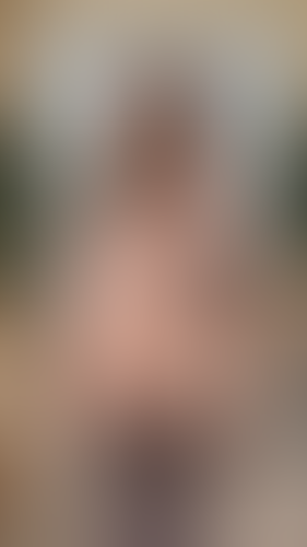 Geblurrte Content-Vorschau