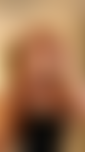 Geblurrte Content-Vorschau