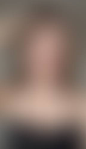 Geblurrte Content-Vorschau