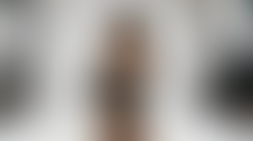 Geblurrte Content-Vorschau