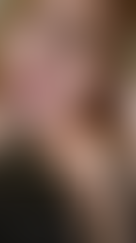 Geblurrte Content-Vorschau