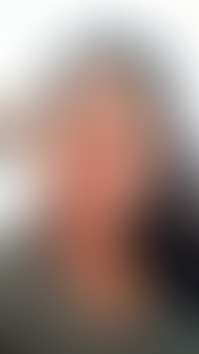 Geblurrte Content-Vorschau