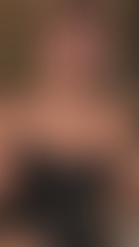 Geblurrte Content-Vorschau