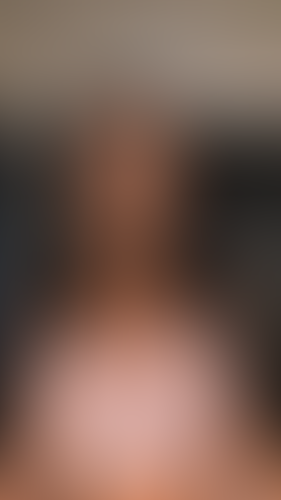 Geblurrte Content-Vorschau