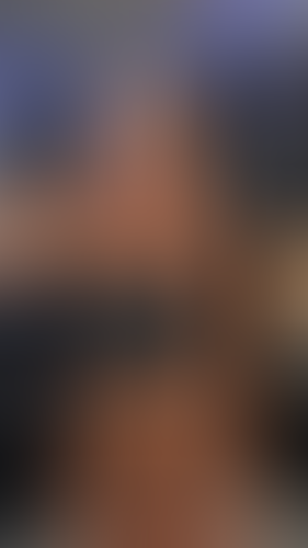 Geblurrte Content-Vorschau