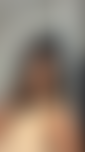 Geblurrte Content-Vorschau