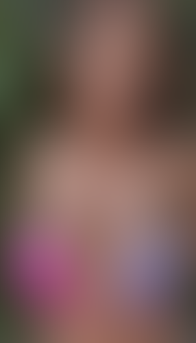 Geblurrte Content-Vorschau