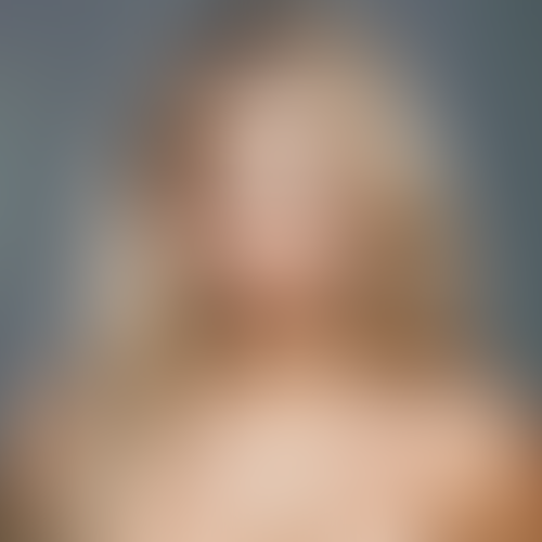 Geblurrte Content-Vorschau