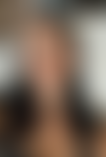 Geblurrte Content-Vorschau