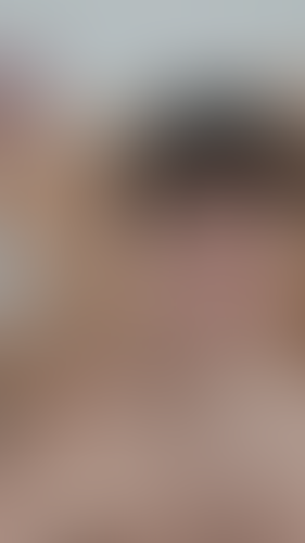 Geblurrte Content-Vorschau