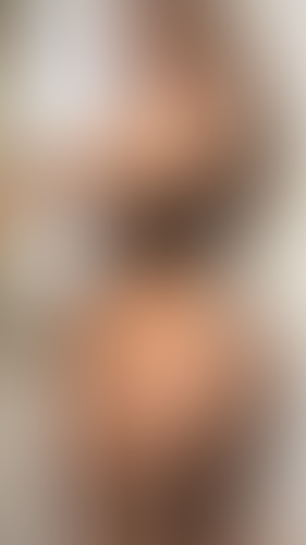 Geblurrte Content-Vorschau