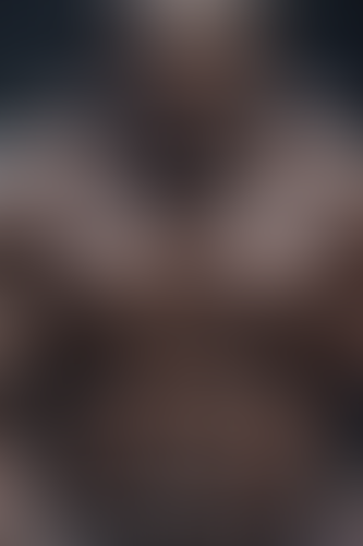 Geblurrte Content-Vorschau