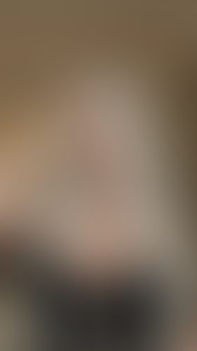 Geblurrte Content-Vorschau