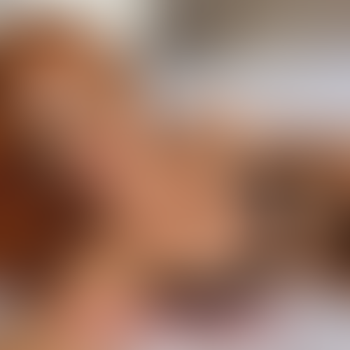 Geblurrte Content-Vorschau