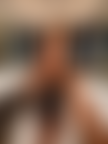 Geblurrte Content-Vorschau