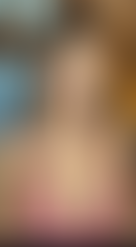 Geblurrte Content-Vorschau
