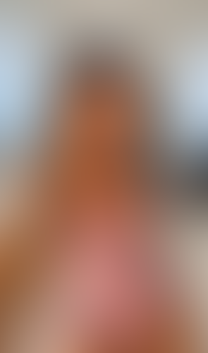 Geblurrte Content-Vorschau