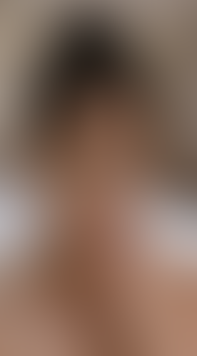 Geblurrte Content-Vorschau