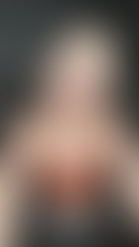 Geblurrte Content-Vorschau