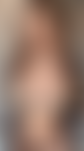 Geblurrte Content-Vorschau