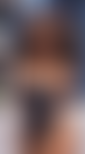 Geblurrte Content-Vorschau