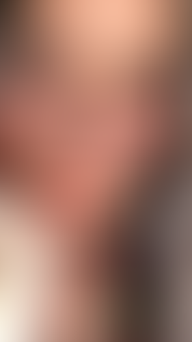 Geblurrte Content-Vorschau