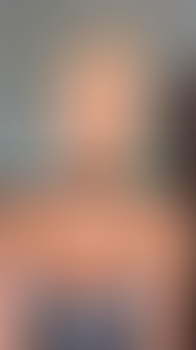 Geblurrte Content-Vorschau