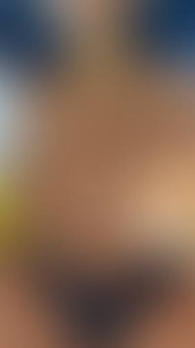 Geblurrte Content-Vorschau
