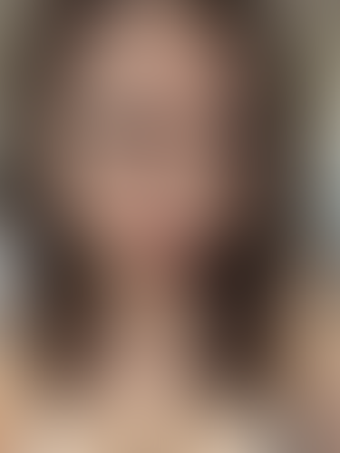 Geblurrte Content-Vorschau