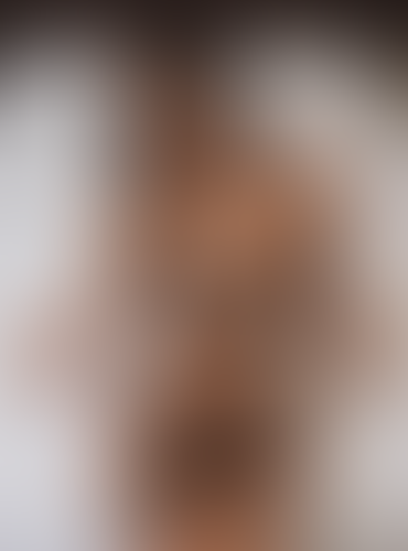 Geblurrte Content-Vorschau
