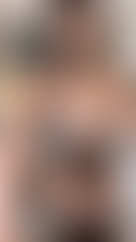 Geblurrte Content-Vorschau