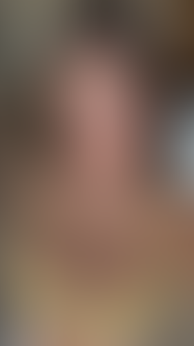Geblurrte Content-Vorschau