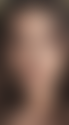 Geblurrte Content-Vorschau