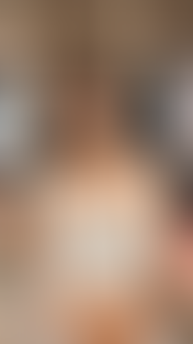 Geblurrte Content-Vorschau