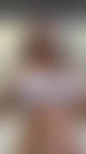 Geblurrte Content-Vorschau