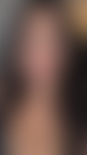 Geblurrte Content-Vorschau