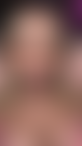 Geblurrte Content-Vorschau