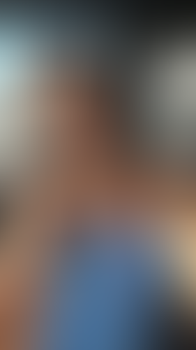Geblurrte Content-Vorschau